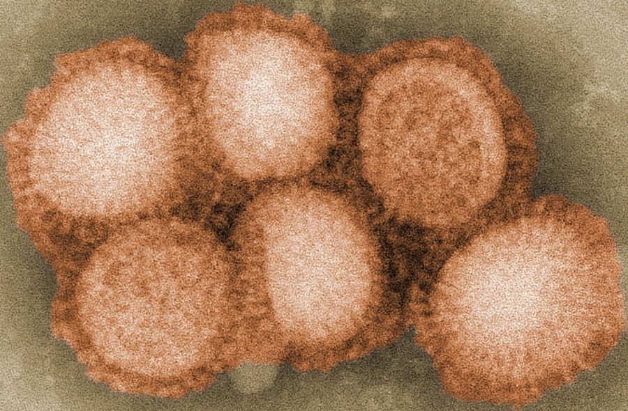 Influenza virus